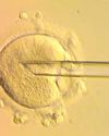 Eight babies with DNA from three people born free of severe hereditary disease7