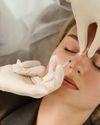 The clampdown on cosmetic procedures is too late for me19