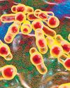 Scientists find germ that consumes hospital plastic16