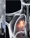 India’s future at risk as young lungs deteriorating: Experts28