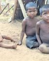 Fresh malnutrition scare grips Jajpur tribal hamlet Fresh malnutrition scare grips Jajpur tribal hamlet26