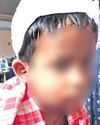 6-year-old boy mauled by stray dogs 6-year-old boy mauled by stray dogs3