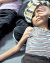 45% of Vellore’s urban slum kids stunted by age two: Study 45% of Vellore’s urban slum kids stunted by age two: Study35