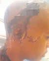LANG PAD LÊ VOOR VIR ACID VICTIM LANG PAD LÊ VOOR VIR ACID VICTIM5
