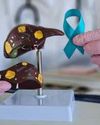 ‘Rising Fatty Liver Cases In Kashmir Due To Sedentary Lifestyles’ ‘Rising Fatty Liver Cases In Kashmir Due To Sedentary Lifestyles’