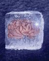 Cryopreservation2
