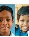 കാറിന് തീപിടിച്ച് പൊള്ളലേറ്റ സഹോദരങ്ങൾ മരിച്ചു0