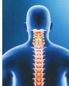 Initiative to treat spinal deformities