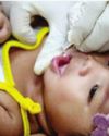 Drop in zero-dose children in India over the past year28