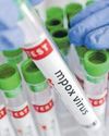 Namibia declares Mpox outbreak, confirmed case in Swakopmund24