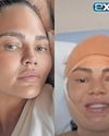 Chrissy Teigen's hairline makeover: what you need to know about this trendy procedure20