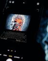 Augment or exit: what a 22-year-old Nigerian app builder and Accenture’s layoffs reveal about AI’s real test43