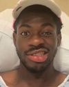 LIL NAS SUFFERS FACE PARALYSIS LIL NAS SUFFERS FACE PARALYSIS