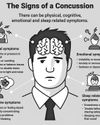 School rugby and head injuries explained School rugby and head injuries explained
