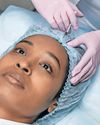 Bridging the cosmetic procedure gap between fair and dark skin