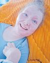 Burn survivor Pippie Kruger celebrates7