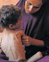 Deaths from hunger rise in Gaza35