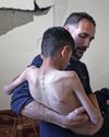 WHO warns of permanent impact of hunger on a generation of Gazans WHO warns of permanent impact of hunger on a generation of Gazans