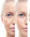 Surgeons warn about 'cheap' cosmetic surgery fixes Surgeons warn about 'cheap' cosmetic surgery fixes8