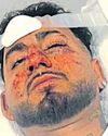 'Racist assault' leaves Mohali man hospitalised in Australia21