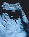 Pete Davidson is going to be dad, expecting first child with girlfriend Pete Davidson is going to be dad, expecting first child with girlfriend83
