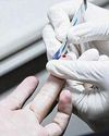 151 new HIV cases in 2024; first time since 1998 number is below 200 151 new HIV cases in 2024; first time since 1998 number is below 20027
