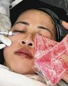 More Singaporeans in their 20s and 30s going for Botox and collagen shots27