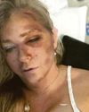 Andrew accuser 'has days to live' Andrew accuser 'has days to live'28