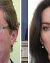 Parents slam spine op failings Parents slam spine op failings