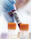 'Universal' blood test for cancers 'Universal' blood test for cancers