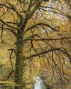 A year in the woods was a tree-mendous way to recover after my surgery A year in the woods was a tree-mendous way to recover after my surgery