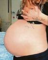 Star Jesy's fella tells of emergency surgery op Star Jesy's fella tells of emergency surgery op