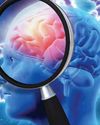 Drug trials hope to halt dementia57