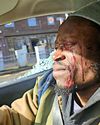 Hip-hop star needs eye surgery after wooden bat attack22