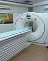 Can CT scans cause cancer? New US study says they could account for 5% of all cancer cases a year30