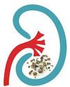 Decoding the link between summer and kidney stones5