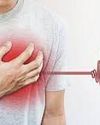 Why smoking is the most serious risk factor for young heart attacks: This 32-year-old had no BP, weight or sugar Indian Chronicle