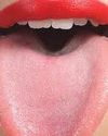 This is what happens to the body when you do not clean your tongue for a month Indian Chronicle
