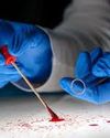 Insects and death intersect in art, poetry, forensics Indian Chronicle