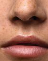 Is Mouth Taping Legit? Is Mouth Taping Legit?7