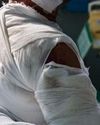 3D-PRINTED SKIN OFFERS NEW HOPE FOR BURN VICTIMS4