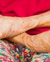 THE LINK BETWEEN LEPROSY AND CLIMATE-CHANGE THAT WE DID NOT KNOW ABOUT: AN INDIAN STORY21