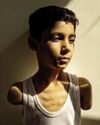 Portrait of amputee Palestinian boy from Gaza wins World Press Photo award9