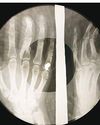 When Elvis and Ella were pressed onto X-rays – subversive legacy of Soviet 'bone music'20