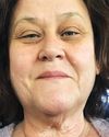 “This ‘neck lift’ boosted my confidence!”
