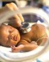 CITIZENSHIP NOT THE ONLY SCARE FOR PRETERM BABIES IN US