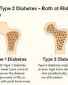 WHY DIABETICS ARE MORE PRONE TO FRACTURES: THE SCIENCE EXPLAINED26