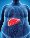 WHY INDIA IS NOW AMONG THE WORLD’S TOP THREE FOR FATTY LIVER DISEASE29