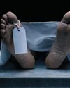 Delhi: 16-year-old girl dies months after suspected acid ingestion; probe underway36