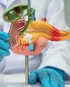 Ozempic: aumentan los casos de pancreatitis aguda1